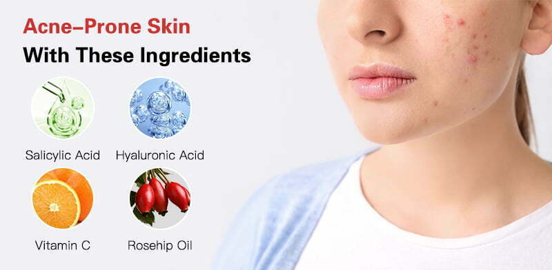 The Most Suitable Ingredients For Specific Skin Types And Needs