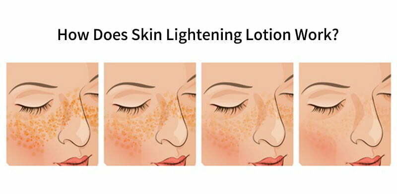 How Does Skin Lightening Lotion Work?