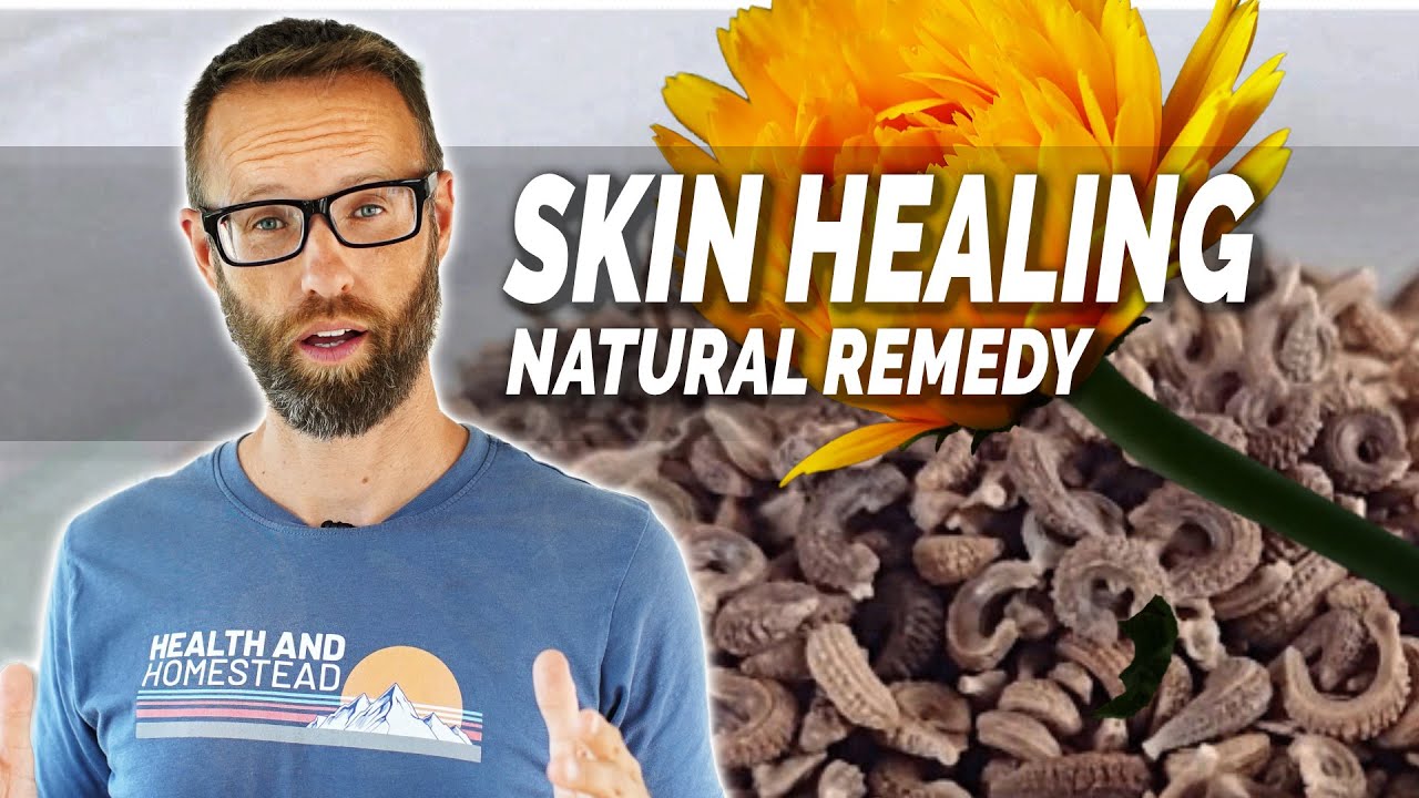 The Healing Powers of Calendula