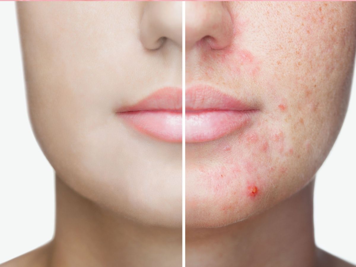 9 Benefits of Dimethicone on Skin Empowering your brand with our top