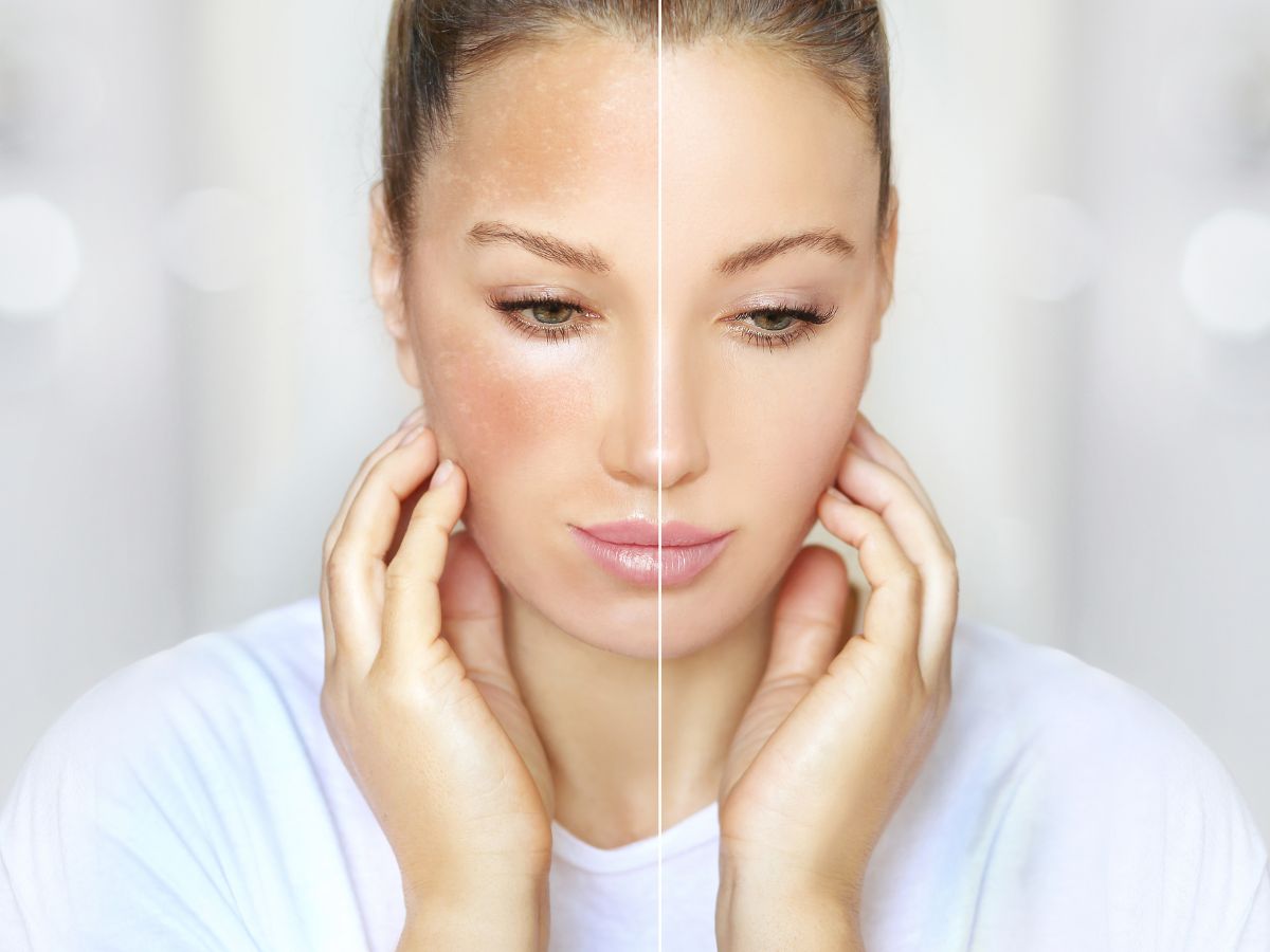 Picture of Discover the Skin Wonders of Vitamin B3 - Empowering your brand with ...