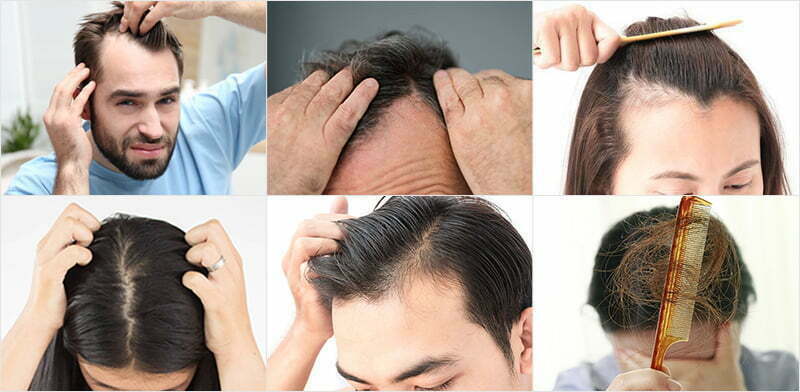 OEM/ODM Private Label Hair Growth Serum