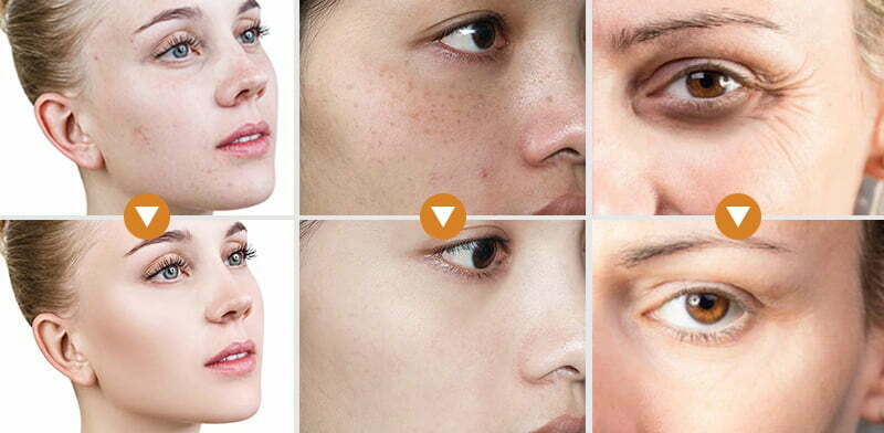 The Benefits Of Retinol On The Skin