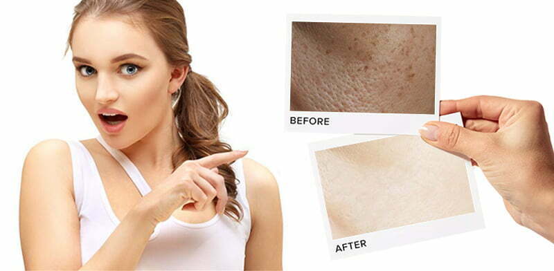 The Benefits Of Using Niacinamide Skin Care Products On The Skin