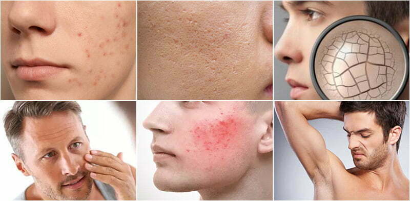 Creating the Right OEM/Private label Skincare Product for Men